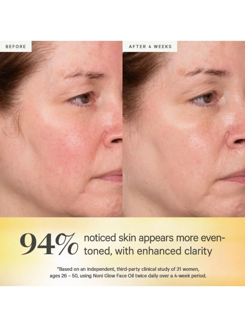 Nourishing Noni Glow Face Oil for All Skin Types - Hydrating Facial Oil